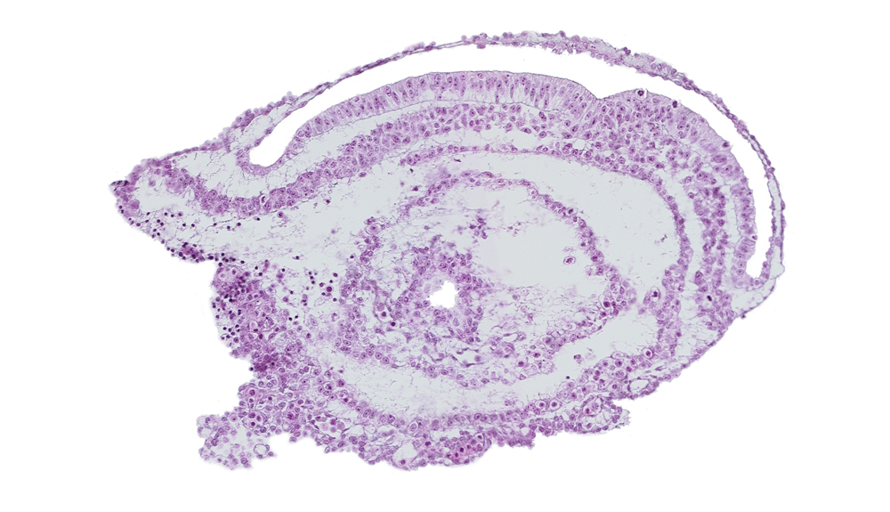 edge of extra-embryonic coelom, gastrulation (primitive) groove, umbilical vesicle cavity