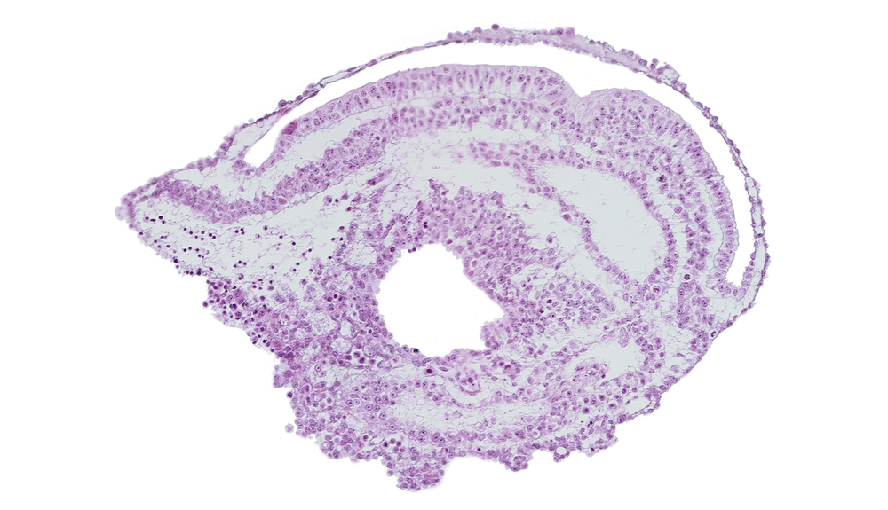 amniotic cavity, extra-embryonic coelom, umbilical vesicle cavity, umbilical vesicle hemangiogenesis