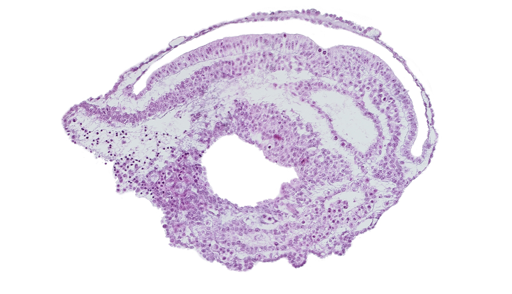 connecting stalk, embryonic endoderm, extra-embryonic coelom, extra-embryonic ectoderm, extra-embryonic endoderm, extra-embryonic mesoderm, gastrulation (primitive) groove, gastrulation (primitive) streak, junction of allantoic diverticulum and umbilical vesicle cavity, umbilical vesicle cavity