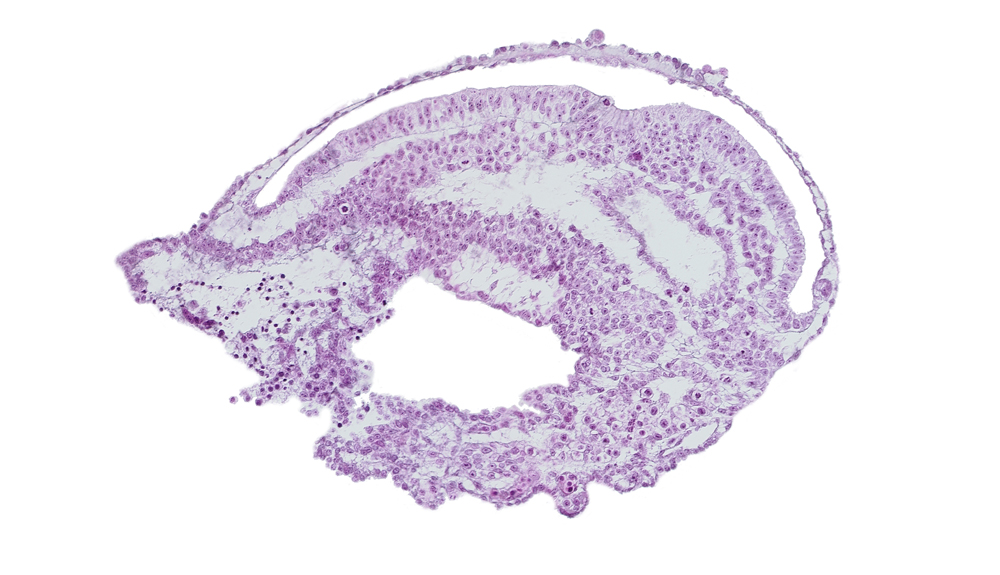 allantoic diverticulum, amnion, blood vessel(s), connecting stalk, endoderm, epiblast, extra-embryonic coelom, extra-embryonic endoderm, gastrulation (primitive) groove, mesoderm, umbilical vesicle cavity