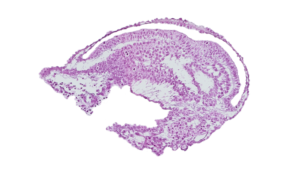 allantoic diverticulum, amniotic cavity, endoderm, extra-embryonic coelom, extra-embryonic endoderm, gastrulation (primitive) groove, mesoderm, umbilical vesicle cavity