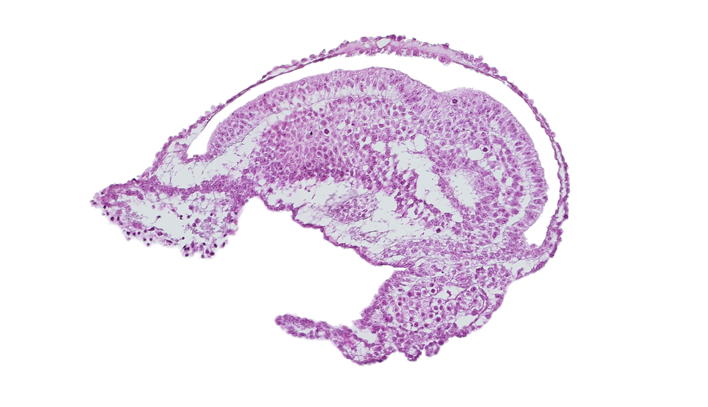 allantoic diverticulum, amnion, amniotic cavity, caudal edge of umbilical vesicle cavity