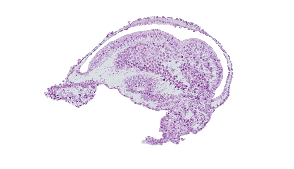 allantoic diverticulum, amnion, amniotic cavity, blood vessel in connecting stalk mesenchyme, cloacal membrane, embryonic ectoderm cut tangentially, embryonic mesoderm, epiblast, extra-embryonic ectoderm, extra-embryonic mesoderm, gastrulation (primitive) groove