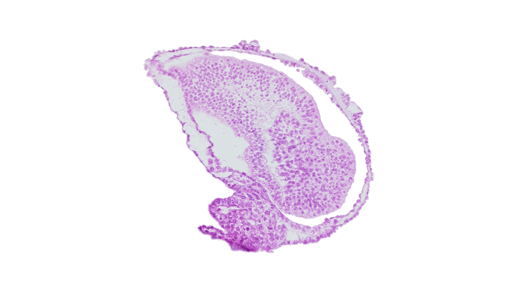 allantoic diverticulum in connecting stalk, amniotic cavity, epiblast, gastrulation (primitive) groove, mesoderm, tail fold region, tangentially cut epiblast