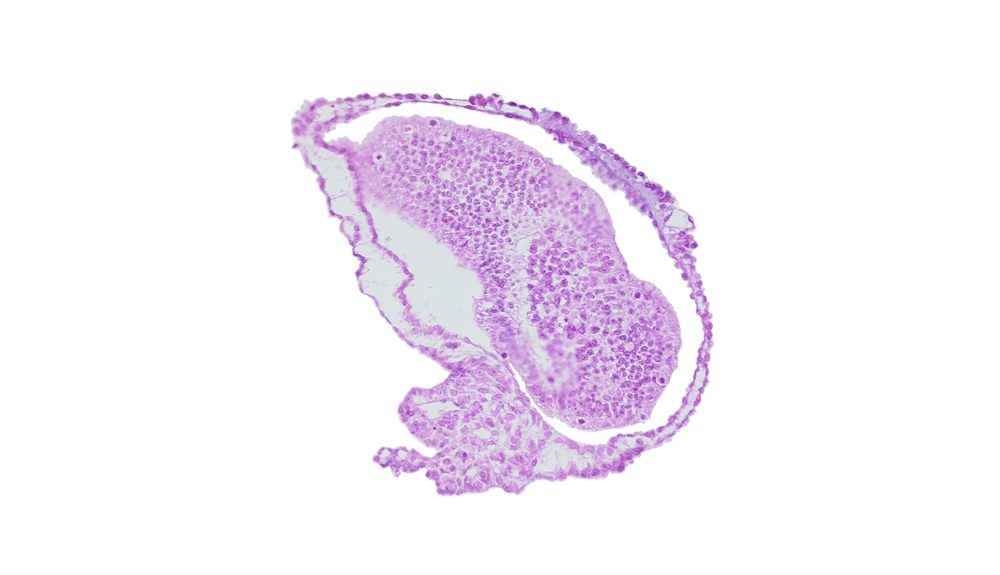 allantoic diverticulum in connecting stalk, amniotic cavity, caudal eminence, gastrulation (primitive) groove, mesoderm, tangentially cut epiblast