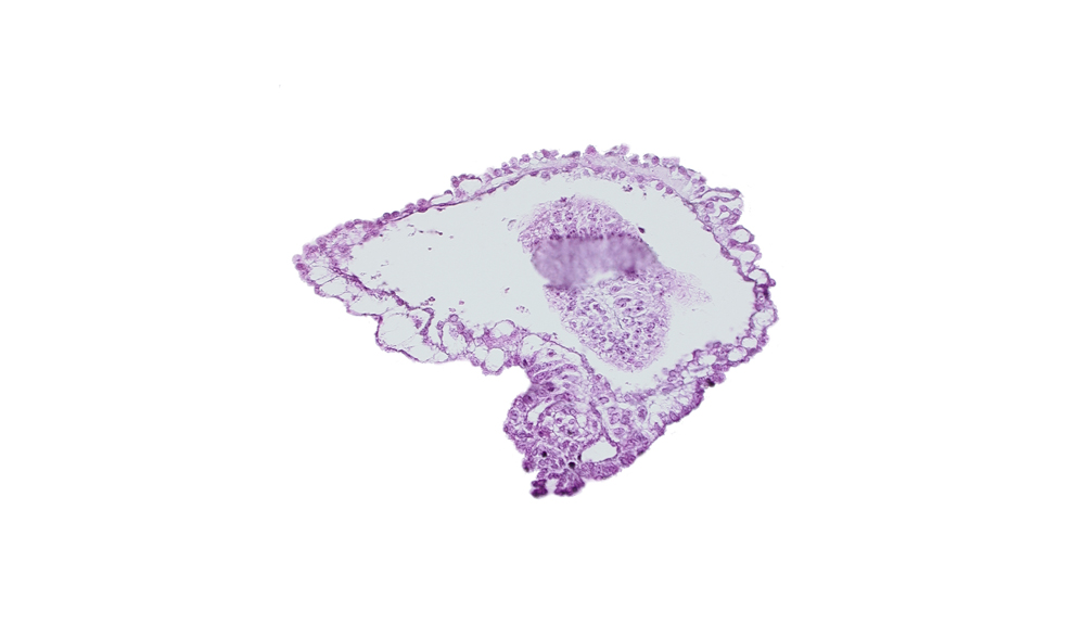 allantoic diverticulum in connecting stalk, amniotic cavity, caudal eminence, extra-embryonic coelom