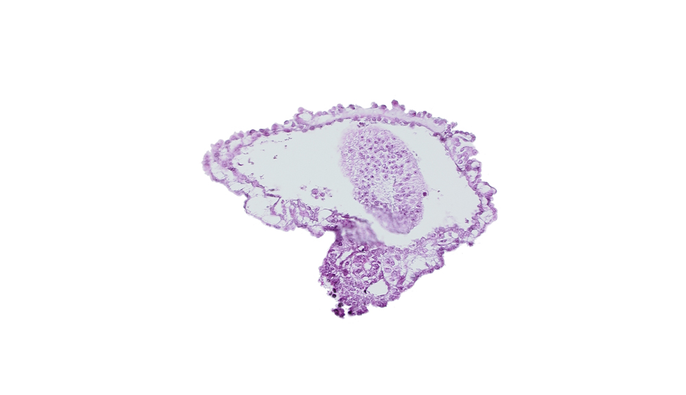 allantoic diverticulum in connecting stalk, amnion, amniotic cavity, epiblast of caudal eminence
