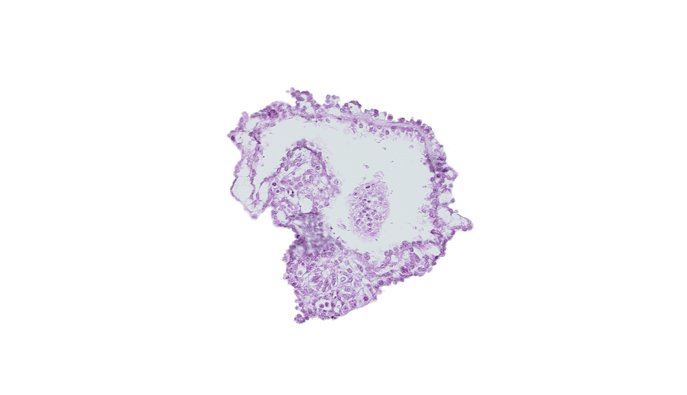 allantoic diverticulum in connecting stalk, amnion, amniotic cavity, caudal eminence