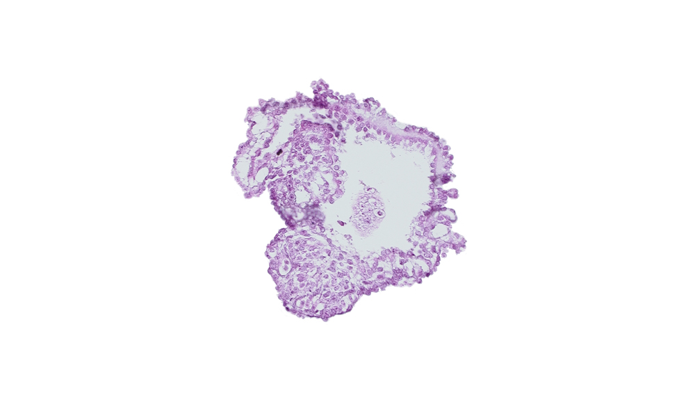 allantoic diverticulum in connecting stalk, amnion, amniotic cavity, caudal edge of caudal eminence, extra-embryonic coelom