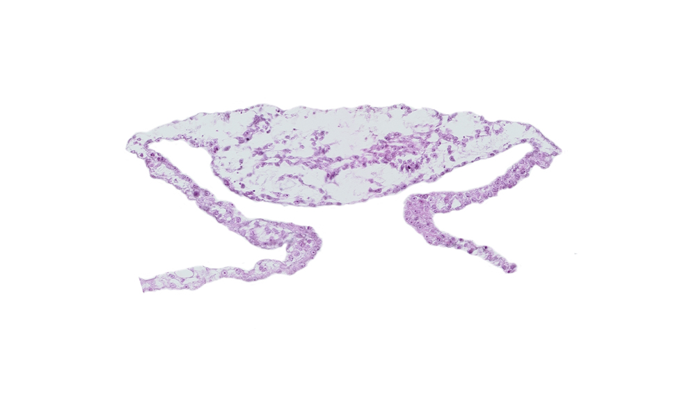 cardiac mesoderm, umbilical vesicle cavity, umbilical vesicle wall