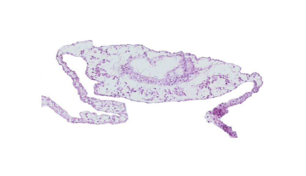 amniotic cavity, cephalic part of neural plate, extra-embryonic mesoderm, head mesenchyme, umbilical vesicle cavity, umbilical vesicle wall