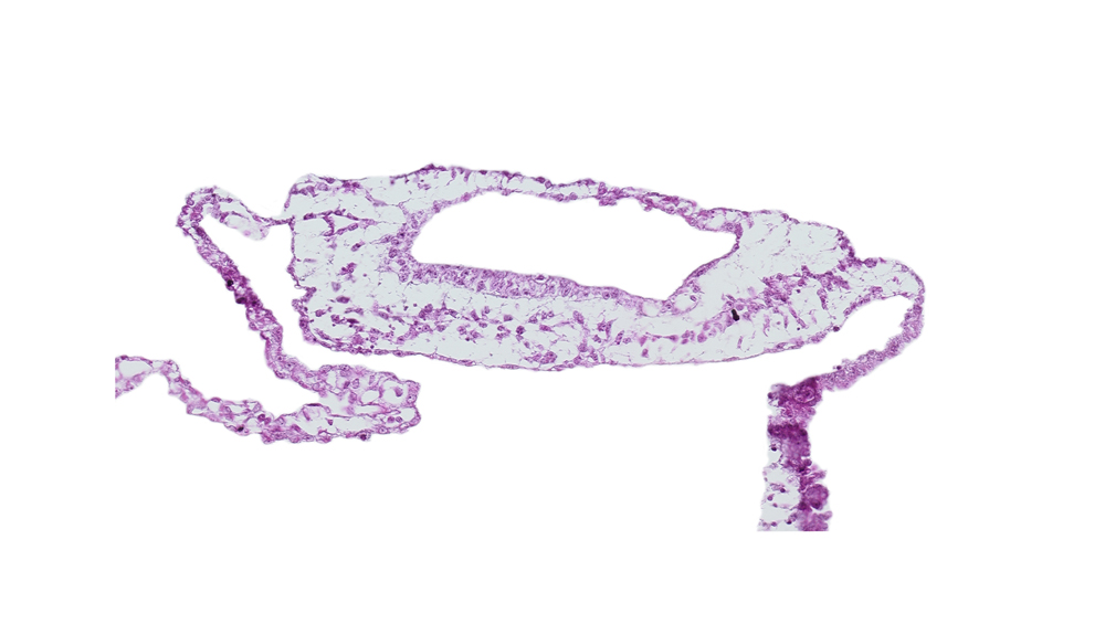 neuroepithelium