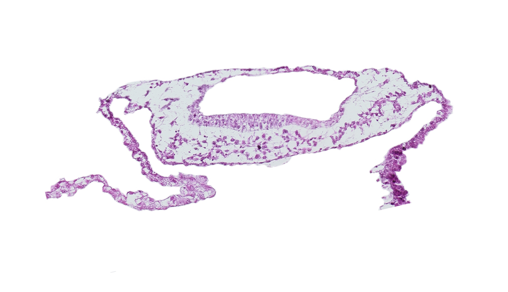 amnion, amniotic cavity