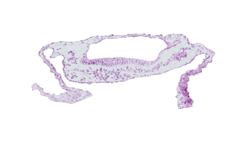 embryonic endoderm, extra-embryonic endoderm, extra-embryonic mesoderm, head mesenchyme, junction of embryonic and extra-embryonic mesoderm, neuroepithelium, neurosomatic junction