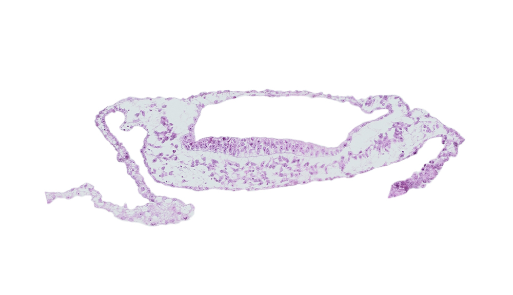 extra-embryonic endoderm, extra-embryonic mesoderm, head mesenchyme, neuroepithelium, neurosomatic junction, umbilical vesicle cavity