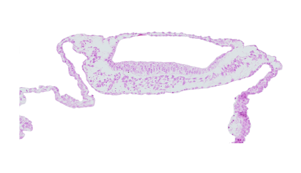 embryonic endoderm, extra-embryonic endoderm, extra-embryonic mesoderm, head mesenchyme, neuroepithelium, neurosomatic junction