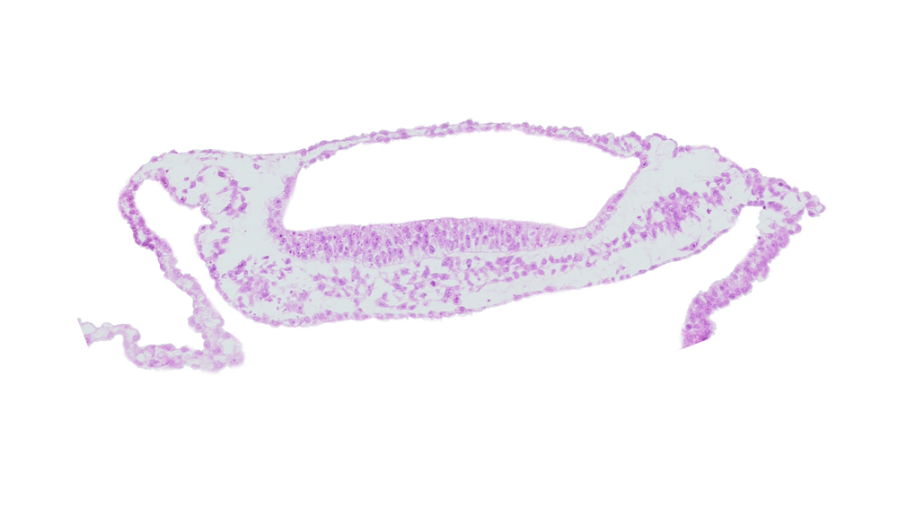 isolated coelomic space, neural plate