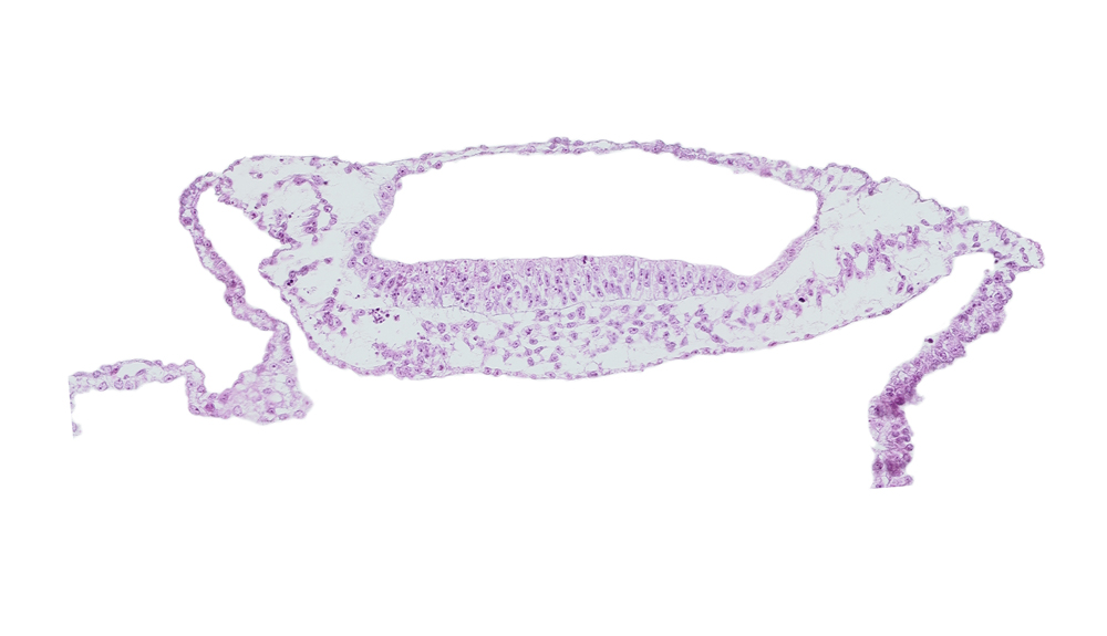 cephalic end of prechordal plate, isolated coelomic space