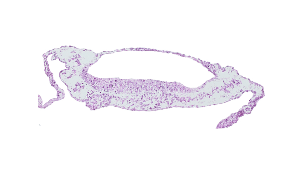 amnion, neuroepithelium, prechordal plate