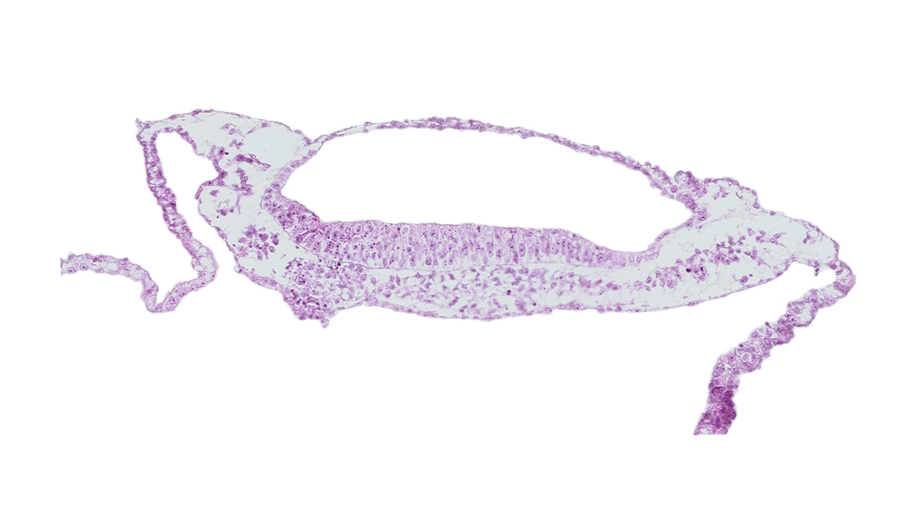 neural groove, prechordal plate