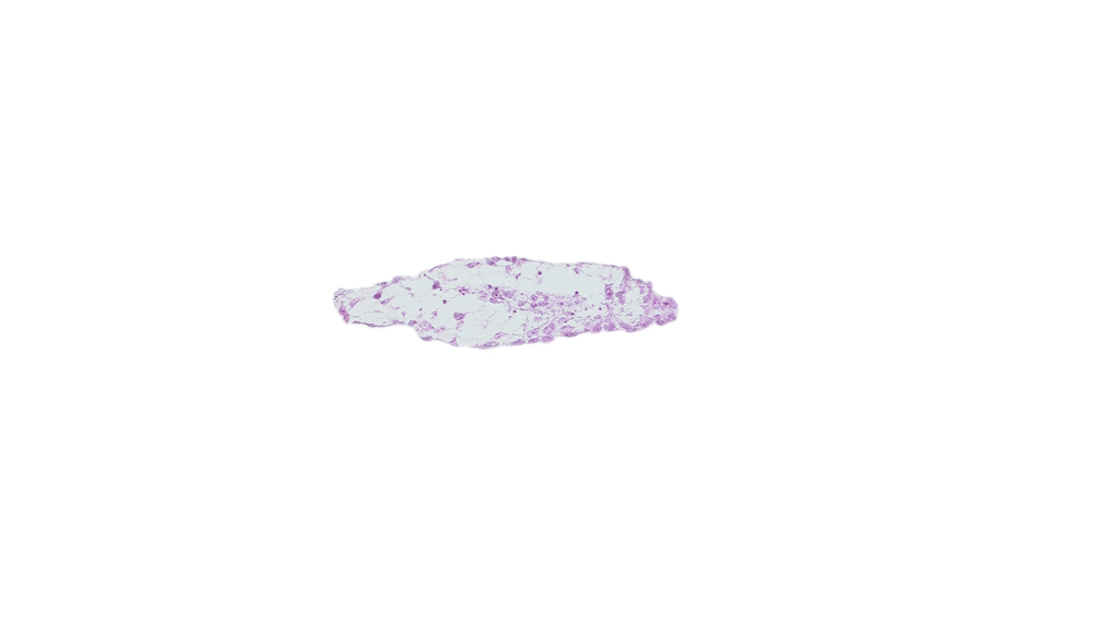 umbilical vesicle wall