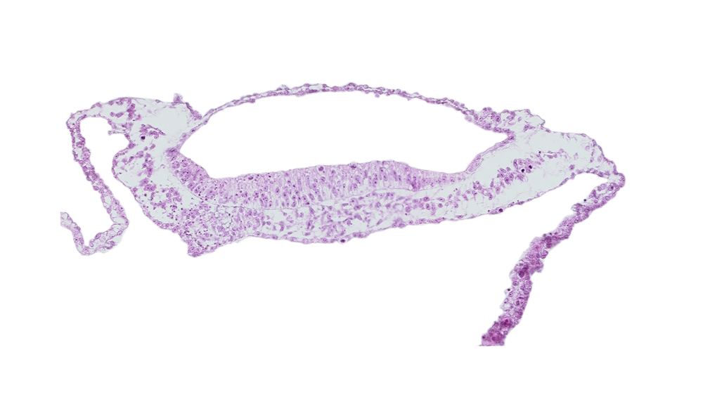 extra-embryonic mesoderm, neural groove, prechordal plate