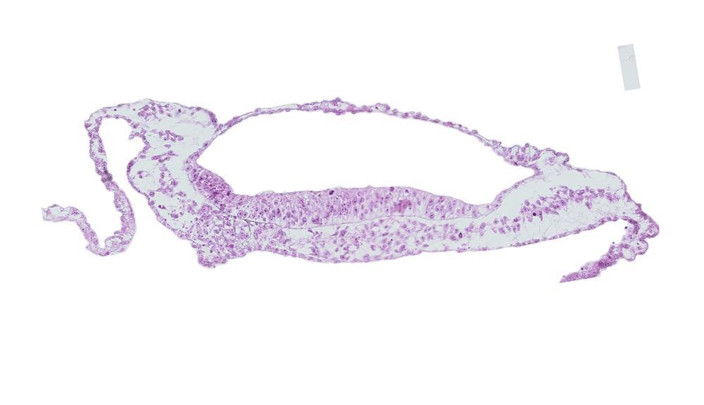 neural groove, prechordal plate