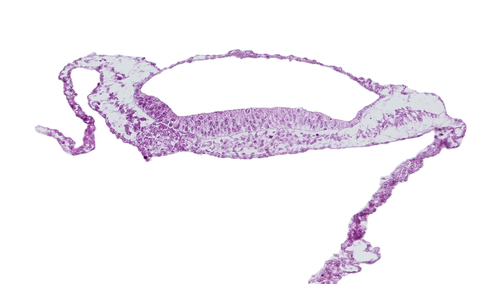 amnion, amniotic cavity, prechordal plate, umbilical vesicle cavity, umbilical vesicle wall