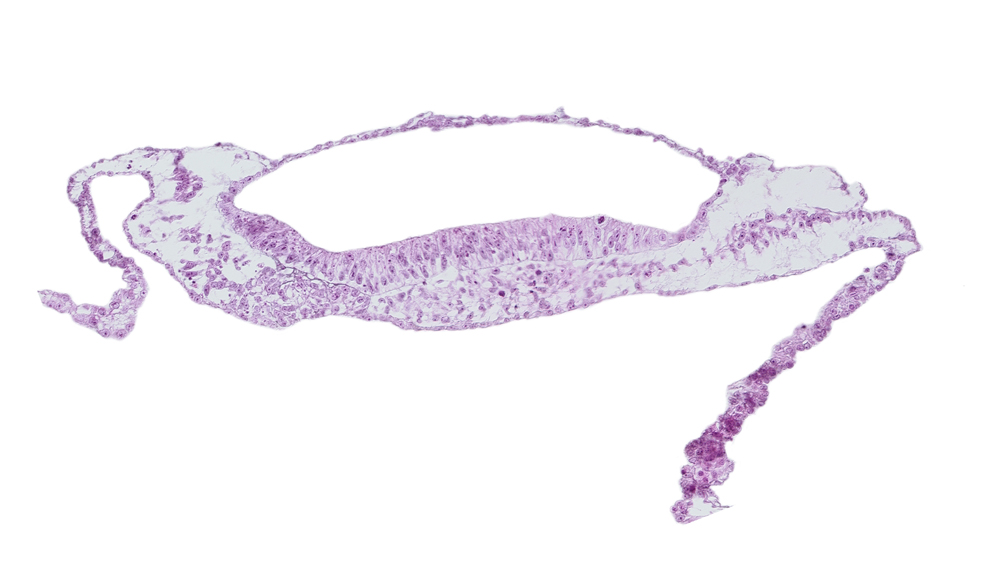 amnion, amniotic cavity, prechordal plate, umbilical vesicle cavity, umbilical vesicle wall