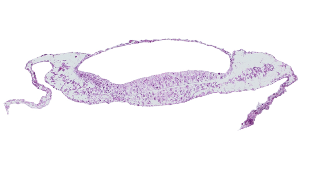 amniotic cavity, prechordal plate