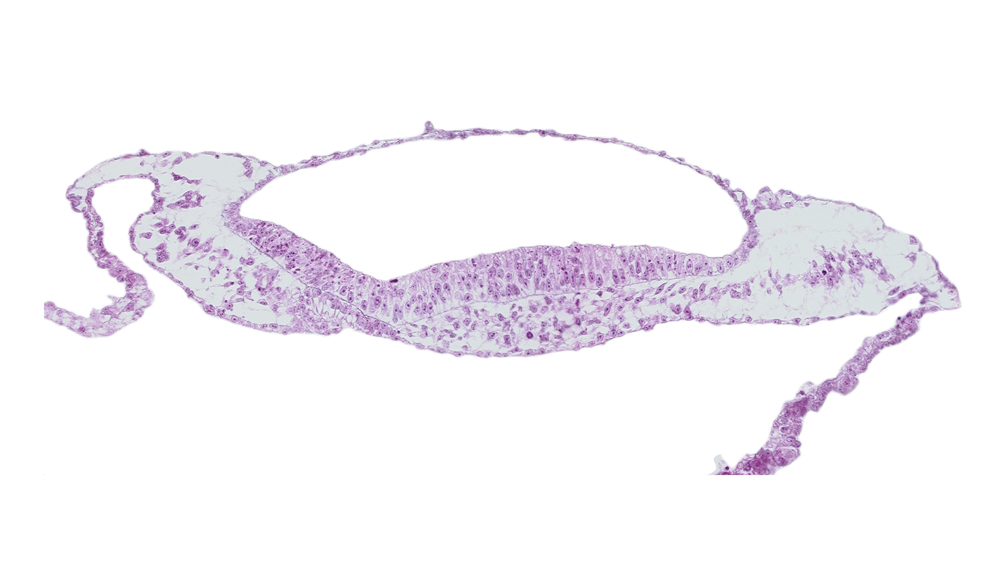 neural groove, neural plate, prechordal plate