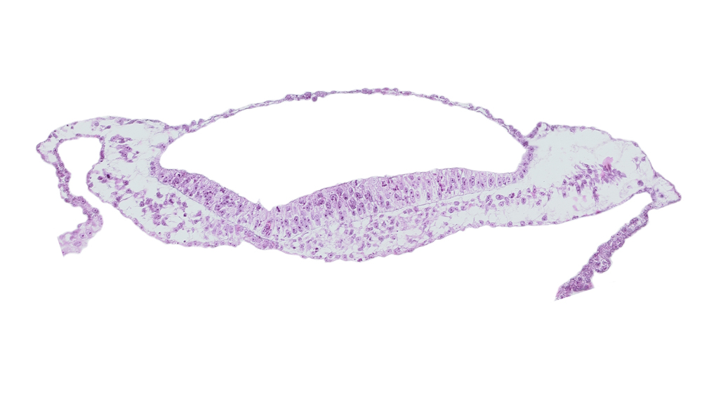 neural groove, prechordal plate