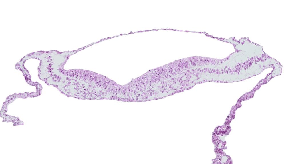 embryonic endoderm, extra-embryonic mesoderm, neural groove