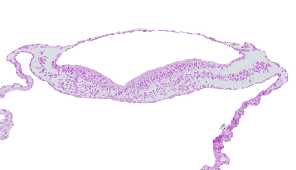 amniotic cavity, head mesenchyme, isolated coelomic space, notochordal plate, umbilical vesicle cavity, umbilical vesicle hemangiogenesis