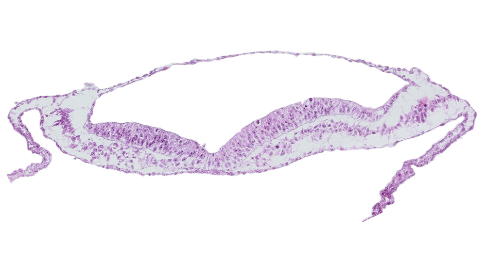 embryonic endoderm, extra-embryonic mesoderm, head mesenchyme, neural ectoderm, neural fold, neural groove, notochordal plate