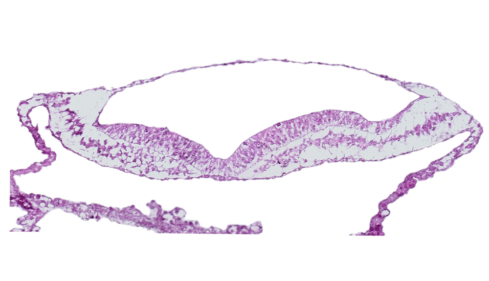 amniotic cavity, head mesenchyme, notochordal plate, umbilical vesicle wall