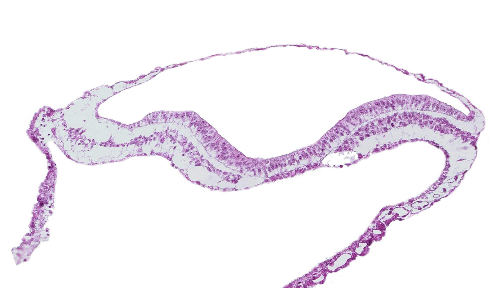 amnion, amniotic cavity, umbilical vesicle cavity, ventral groove (artifact?)