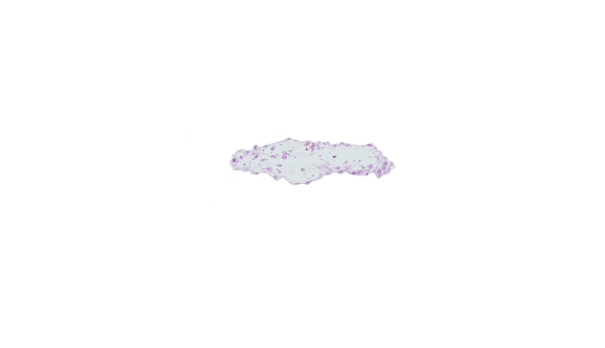 edge of umbilical vesicle wall