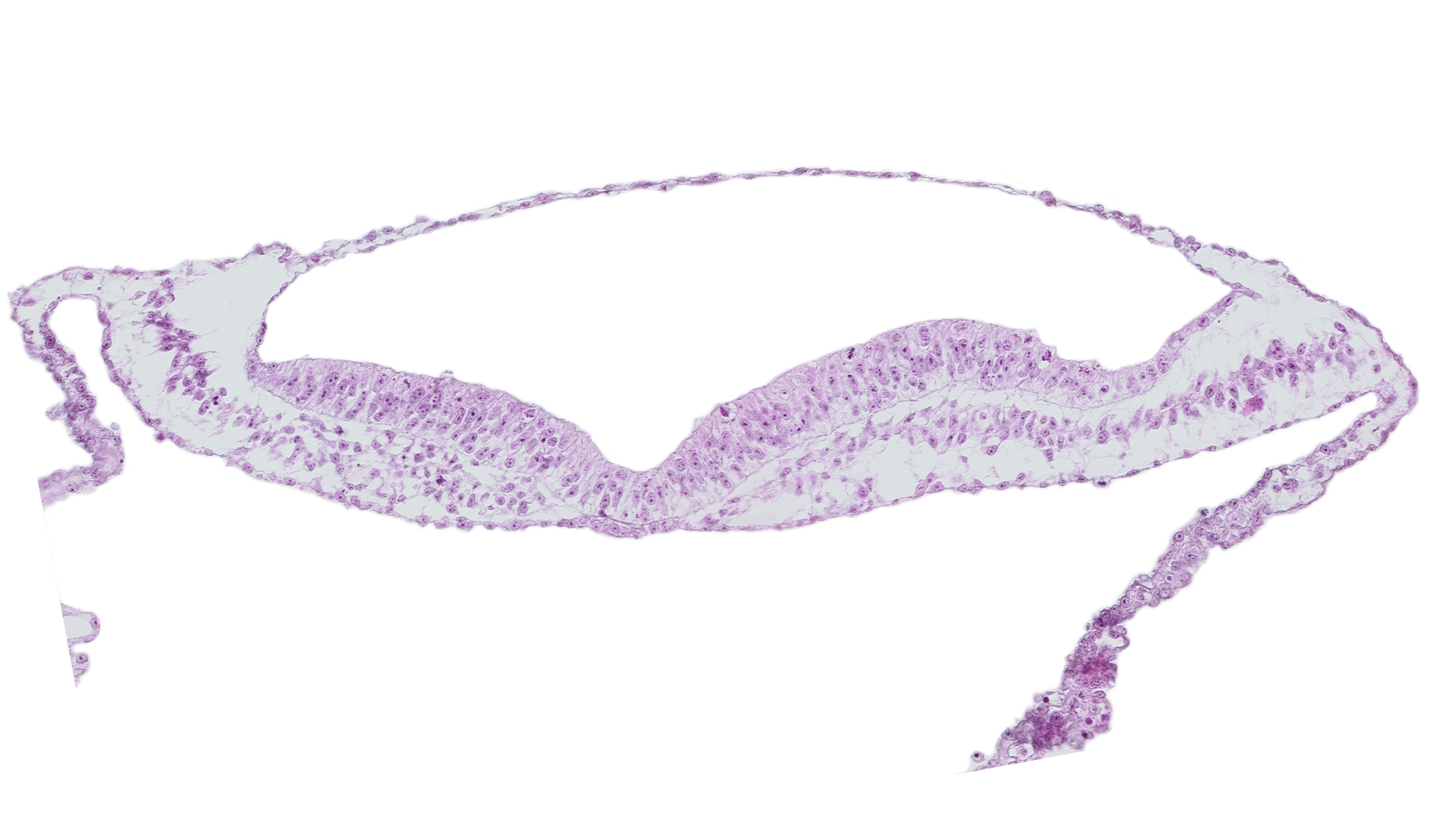 embryonic endoderm, extra-embryonic mesoderm, head mesenchyme, neural ectoderm, neural fold, neural groove, notochordal plate