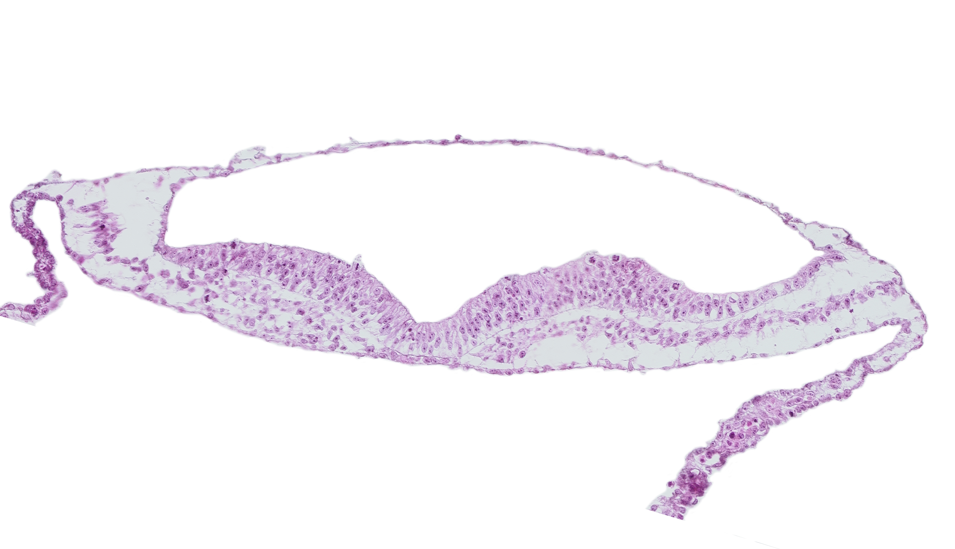 extra-embryonic mesoderm, head mesenchyme, neural ectoderm