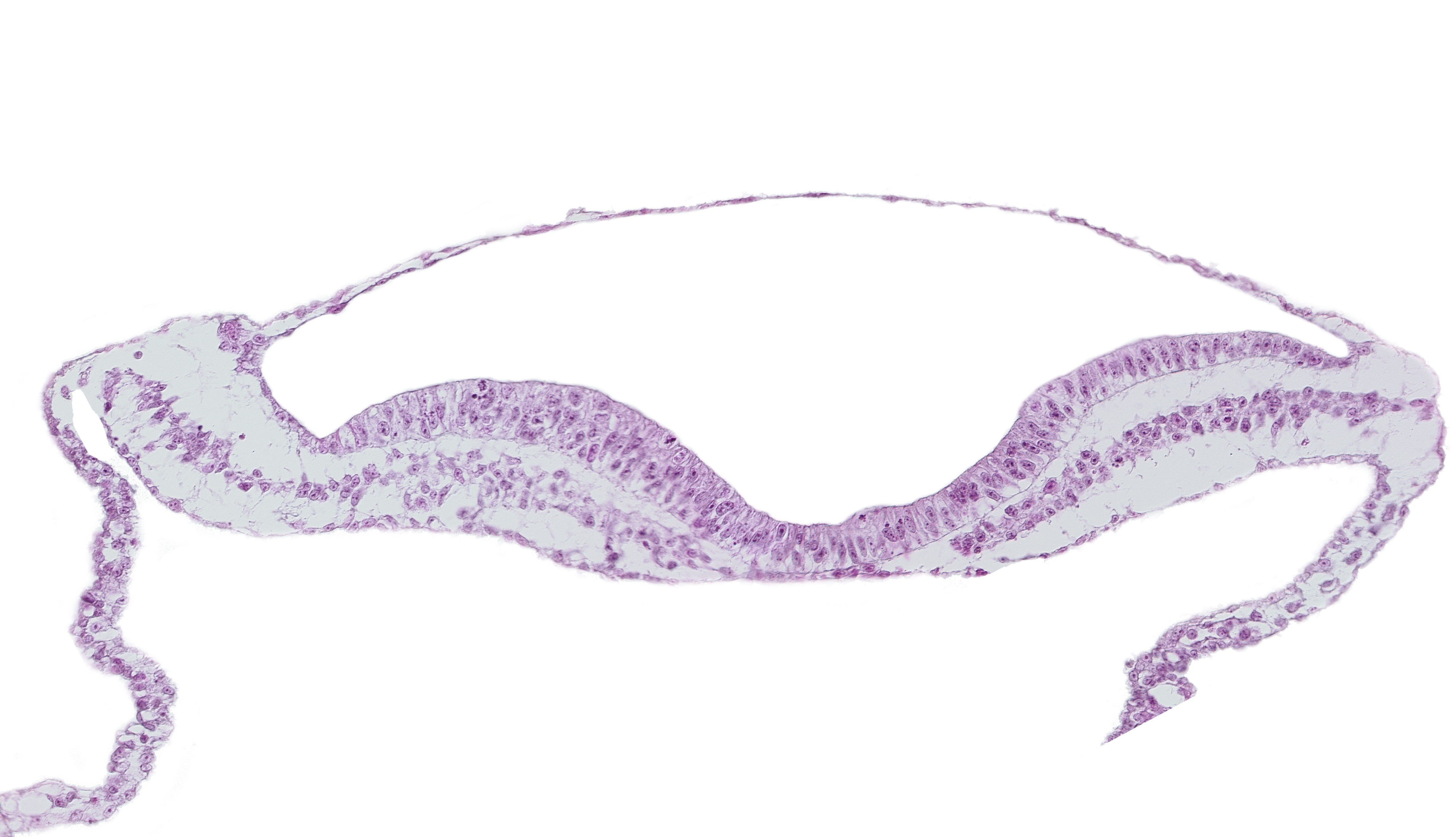 amnion, amniotic cavity, endoderm