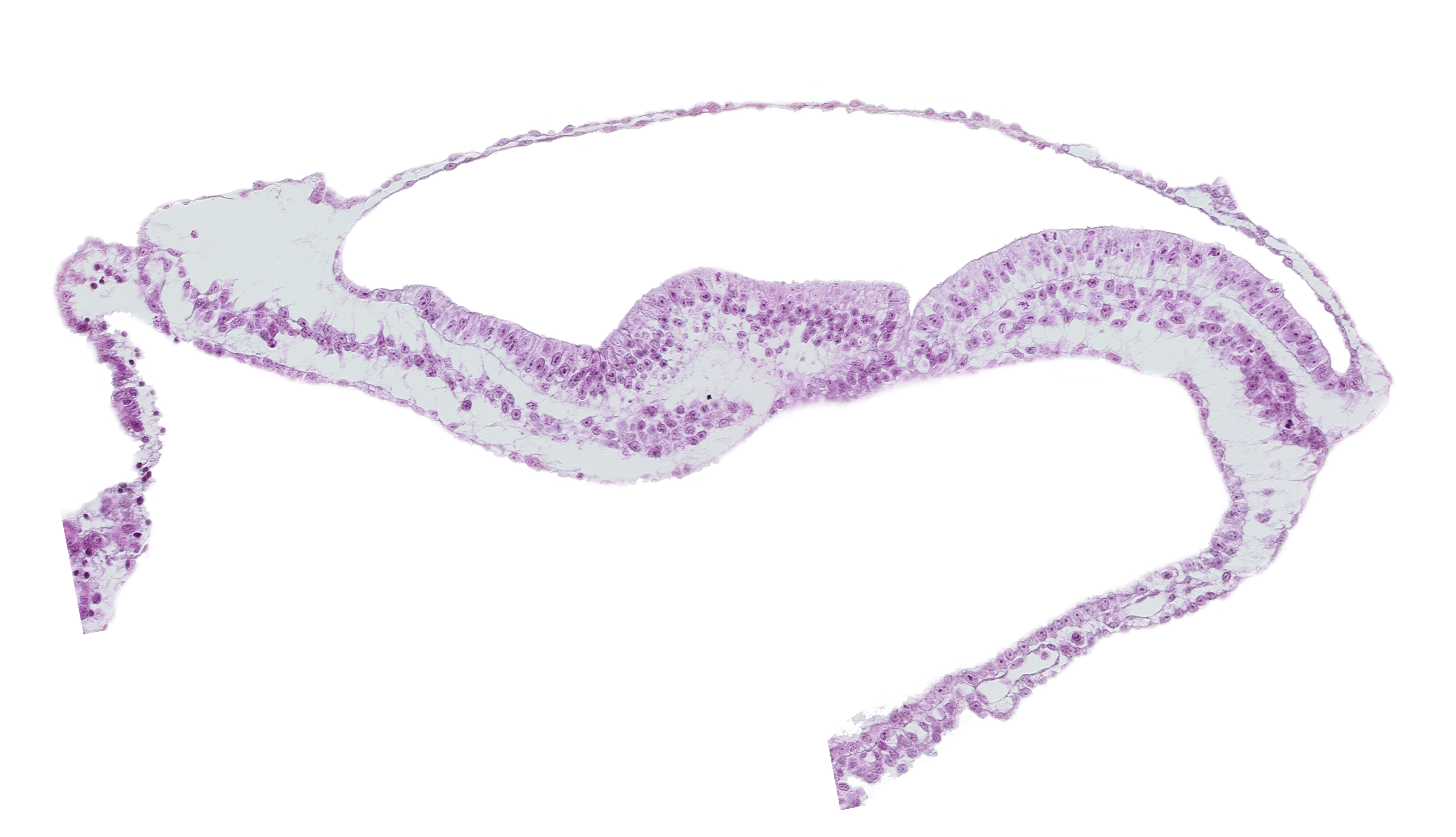 lateral plate mesoderm, notochordal (primitive) pit, notochordal process, transverse groove