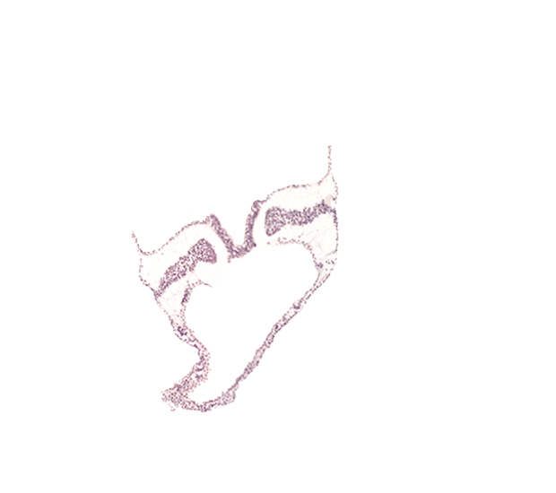 artifact separation(s), caudal intestinal portal, intermediate mesenchyme, lateral plate mesoderm, neural plate, notochordal plate, paraxial mesoderm, spinal cord primordium, umbilical vesicle wall