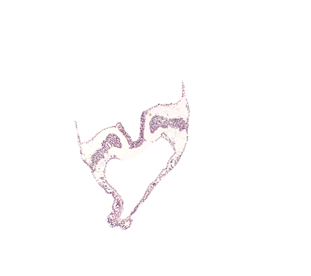 artifact separation(s), caudal part of umbilical vesicle cavity, hindgut primordium (lumen), intermediate mesenchyme, lateral plate mesoderm, paraxial mesoderm