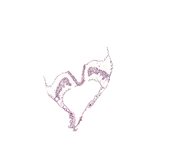 angioblastic tissue, artifact separation(s), hindgut primordium (lumen), lateral plate mesoderm, paraxial mesoderm