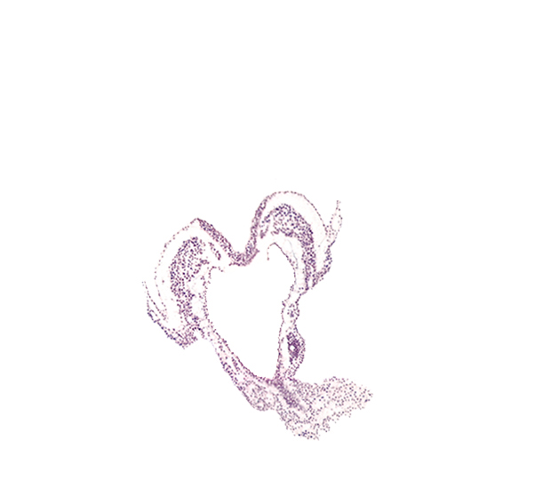 cephalic edge of allantoic diverticulum, hindgut primordium (lumen), primordial left dorsal aorta, primordial right dorsal aorta