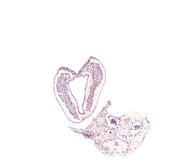 amnion attachment, caudal part of neural plate, connecting stalk, hindgut primordium (lumen), left umbilical vein, notochordal (primitive) pit, right umbilical vein, surface ectoderm, tail fold region, ventral ectodermal ridge