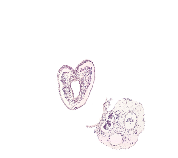 allantoic diverticulum, amnion attachment, common umbilical vein, gastrulation (primitive) streak, hindgut primordium (lumen), left umbilical artery, neural cord, right umbilical artery