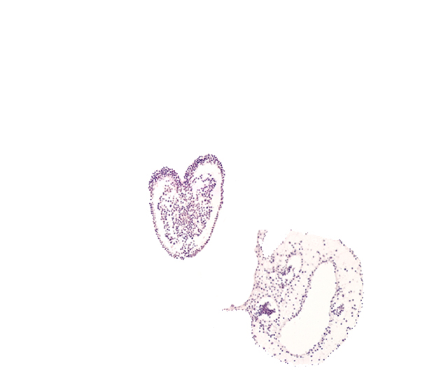 amniotic cavity, caudal edge of hindgut primordium (lumen), common umbilical artery, connecting stalk, gastrulation (primitive) streak, left umbilical vein, right umbilical vein, ventral ectodermal ridge