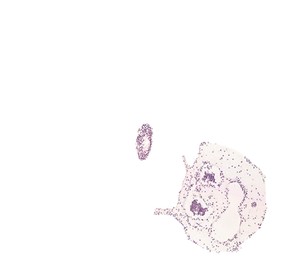 caudal edge of allantoic diverticulum, caudal eminence, common umbilical artery, left umbilical vein, right umbilical vein